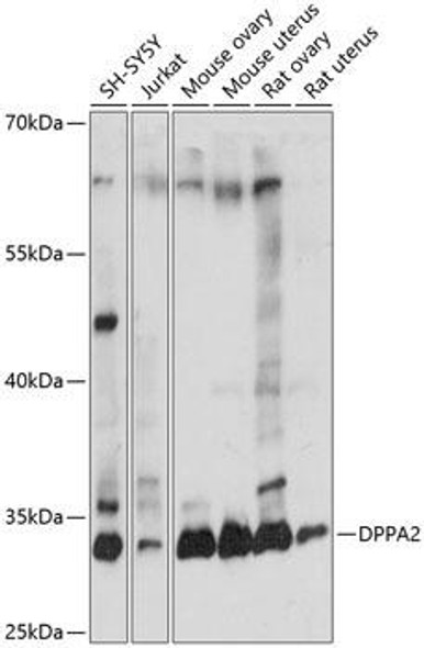 Anti-DPPA2 Antibody (CAB14966)