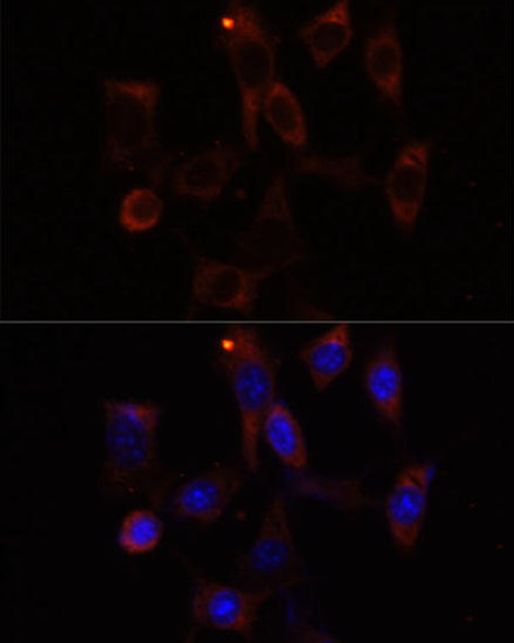 Anti-YTHDC2 Antibody (CAB15004)