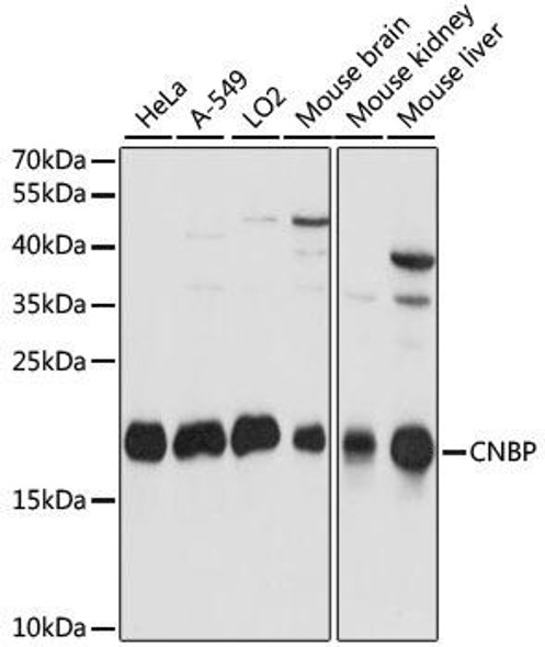 Anti-CNBP Antibody (CAB15110)