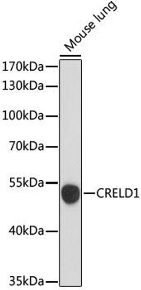Anti-CRELD1 Antibody (CAB15186)