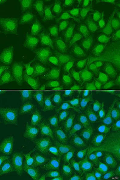 Anti-ATG4C Antibody (CAB15200)