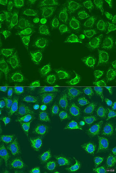 Anti-ALG2 Antibody (CAB15203)