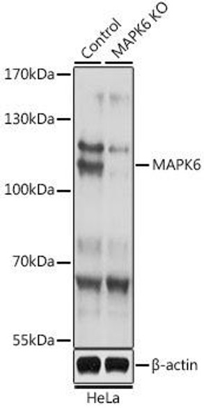 Anti-MAPK6 Antibody (CAB15304)[KO Validated]