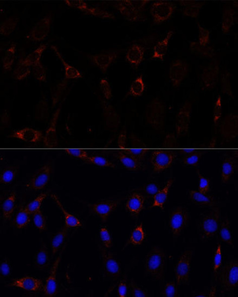 Anti-RNF112 Antibody (CAB15333)