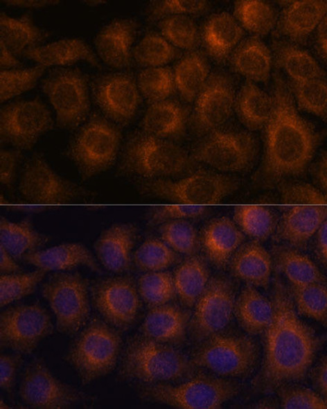 Anti-VAV3 Antibody (CAB15385)