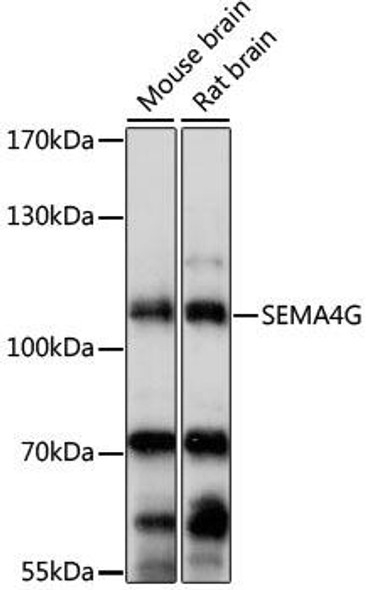 Anti-SEMA4G Antibody (CAB15492)