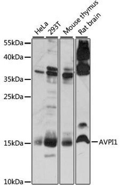 Anti-AVPI1 Antibody (CAB15497)