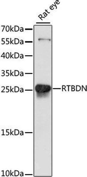 Anti-RTBDN Antibody (CAB15525)