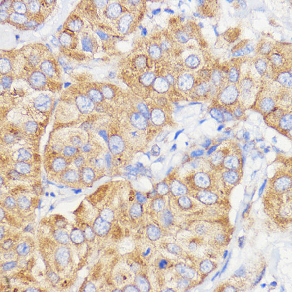 Anti-COL2A1 Antibody (CAB1560)