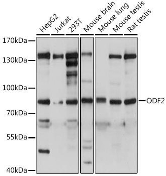 Anti-ODF2 Antibody (CAB15630)