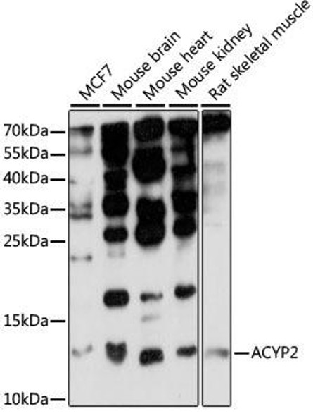 Anti-ACYP2 Antibody (CAB15636)