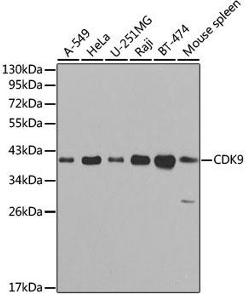 Anti-CDK9 Antibody (CAB1564)