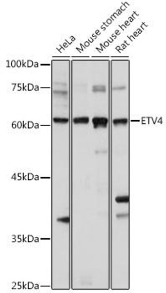 Anti-ETV4 Antibody (CAB15667)