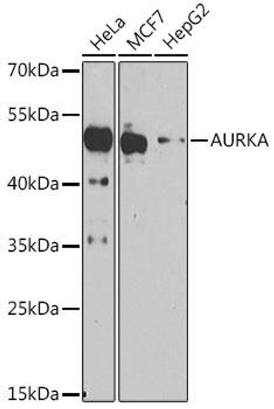 Anti-AURKA Antibody (CAB15728)