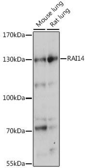 Anti-RAI14 Antibody (CAB15811)