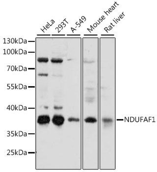 Anti-NDUFAF1 Antibody (CAB15835)