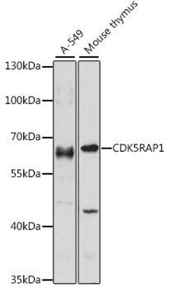 Anti-CDK5RAP1 Antibody (CAB15844)