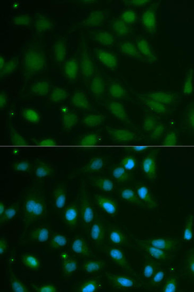 Anti-ABO Antibody (CAB1586)