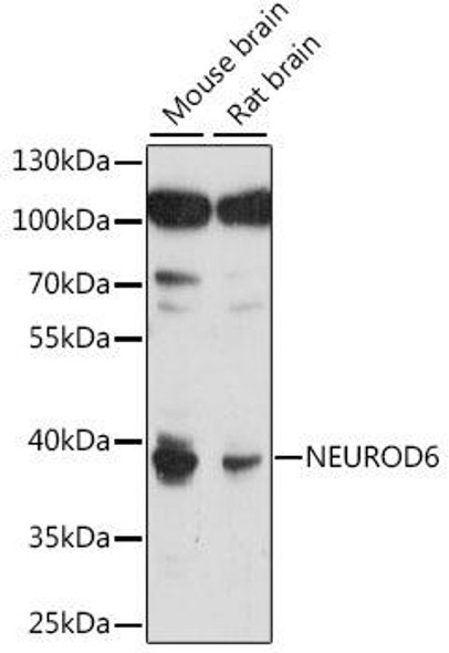 Anti-NEUROD6 Antibody (CAB15881)