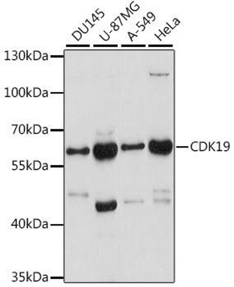 Anti-CDK19 Antibody (CAB16109)