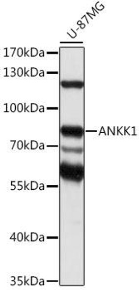 Anti-ANKK1 Antibody (CAB16178)