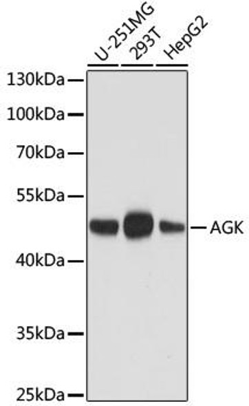 Anti-AGK Mouse Monoclonal Antibody (CAB16230)