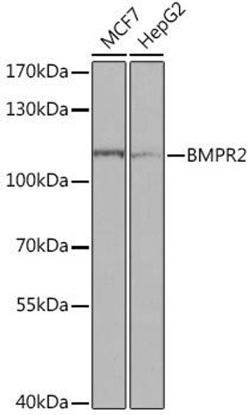 Anti-BMPR2 Antibody (CAB16232)