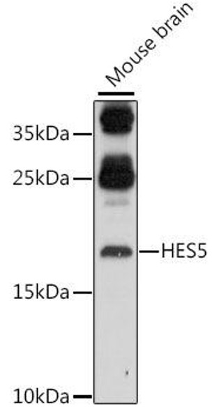 Anti-HES5 Antibody (CAB16237)