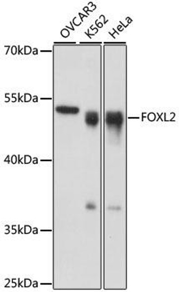 Anti-FOXL2 Antibody (CAB16244)