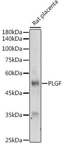 Anti-PLGF Antibody (CAB16257)