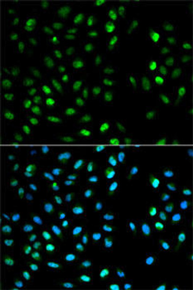 Anti-DTNBP1 Antibody (CAB1632)