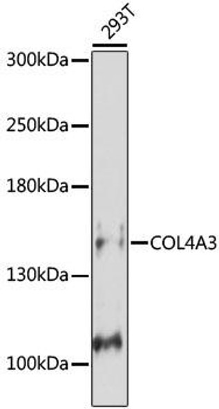Anti-COL4A3 Antibody (CAB16359)
