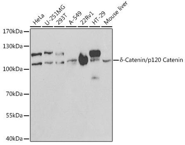 Anti-Delta-Catenin/p120 Catenin Antibody (CAB1641)