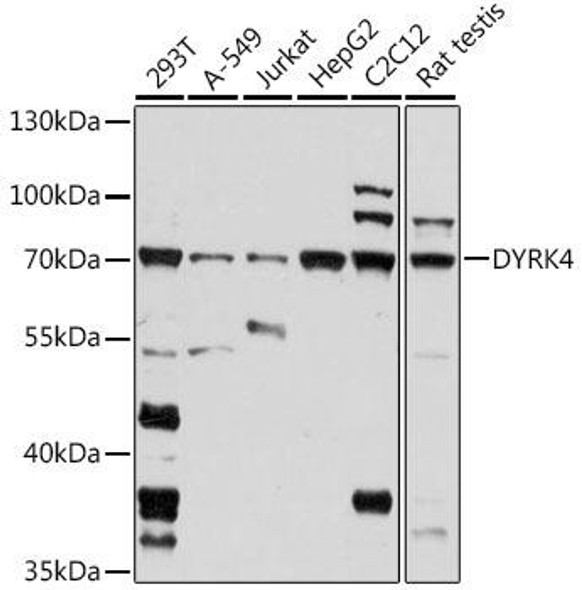 Anti-DYRK4 Antibody (CAB16460)