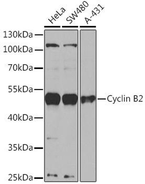 Anti-Cyclin B2 Antibody (CAB16463)