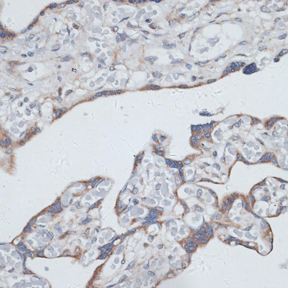 Anti-PLAA Antibody (CAB16466)