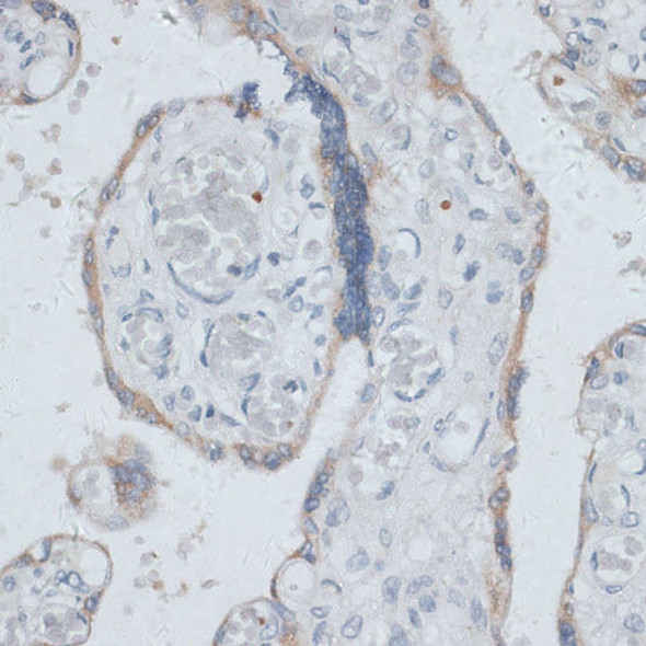 Anti-DTNBP1 Antibody (CAB16581)