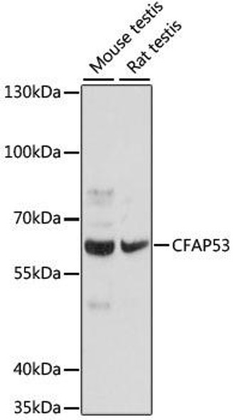 Anti-CFAP53 Antibody (CAB16607)