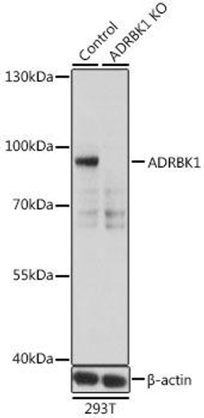 Anti-ADRBK1 Antibody (CAB1662)[KO Validated]