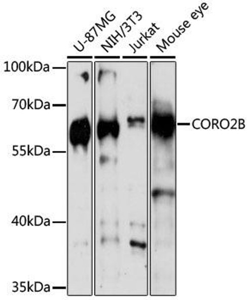 Anti-CORO2B Antibody (CAB16670)