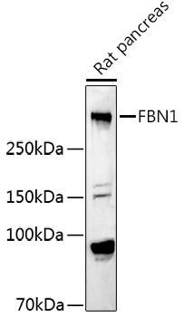 FBN1 Rabbit Polyclonal Antibody (CAB16677)