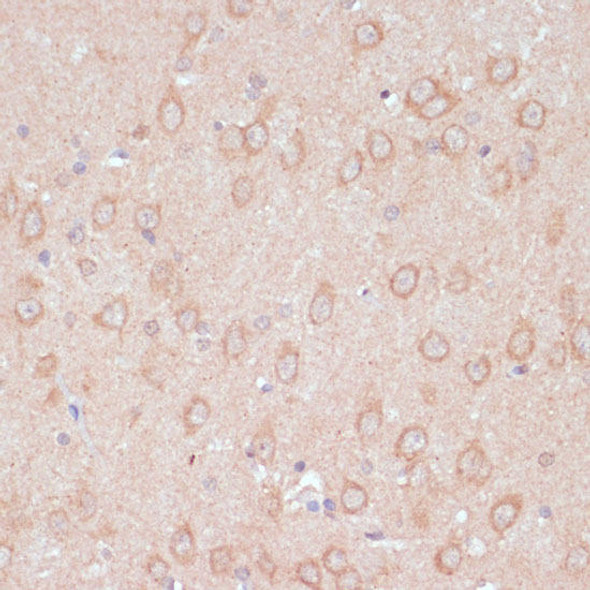 Anti-ARL4D Antibody (CAB16761)