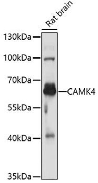 Anti-CAMK4 Antibody (CAB16787)