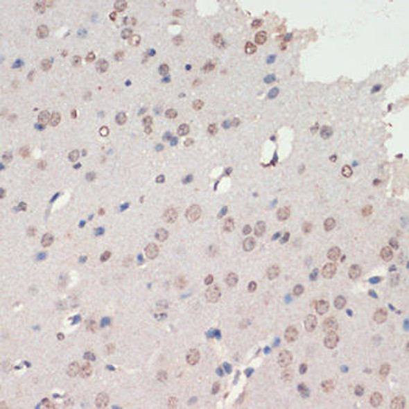 Anti-NEUROD1 Antibody (CAB16927)