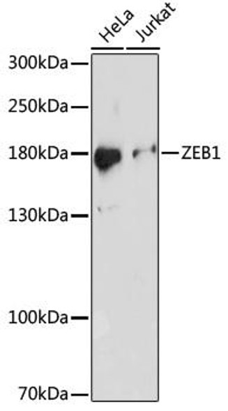 Anti-ZEB1 Antibody (CAB16981)