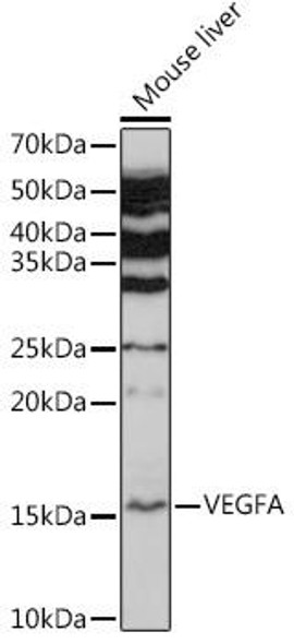 Anti-VEGFA Antibody (CAB17000)