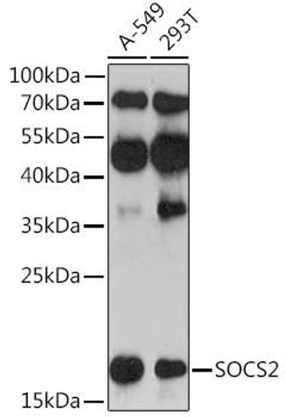Anti-SOCS2 Antibody (CAB17035)