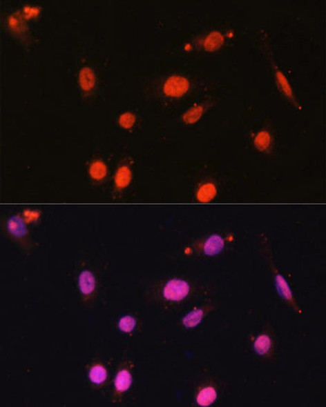 Anti-DDX17 Antibody (CAB17078)