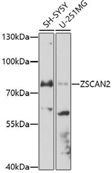Anti-ZSCAN2 Antibody (CAB17173)