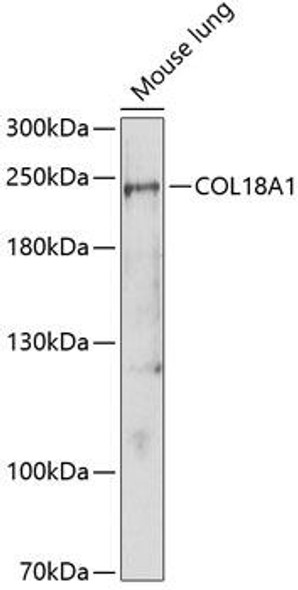 Anti-COL18A1 Antibody (CAB1722)